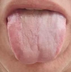 脾肾亏虚体质偏弱，中医调养先后天以扶助正气





许多男士朋友们出现了功能障