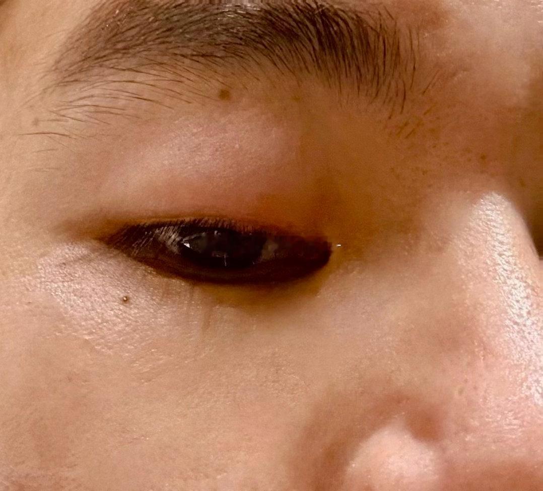 左眼睛有点肿了。好无语😅？咋回事