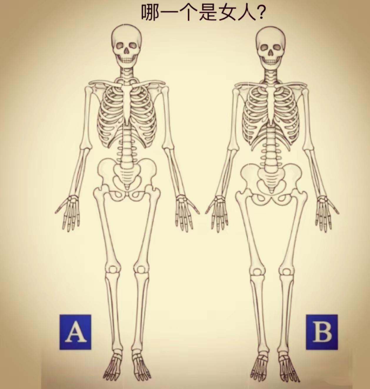 问了100个人，90个答错，我敢说，只有生物知识相当不错的人才能正确看出来，不信
