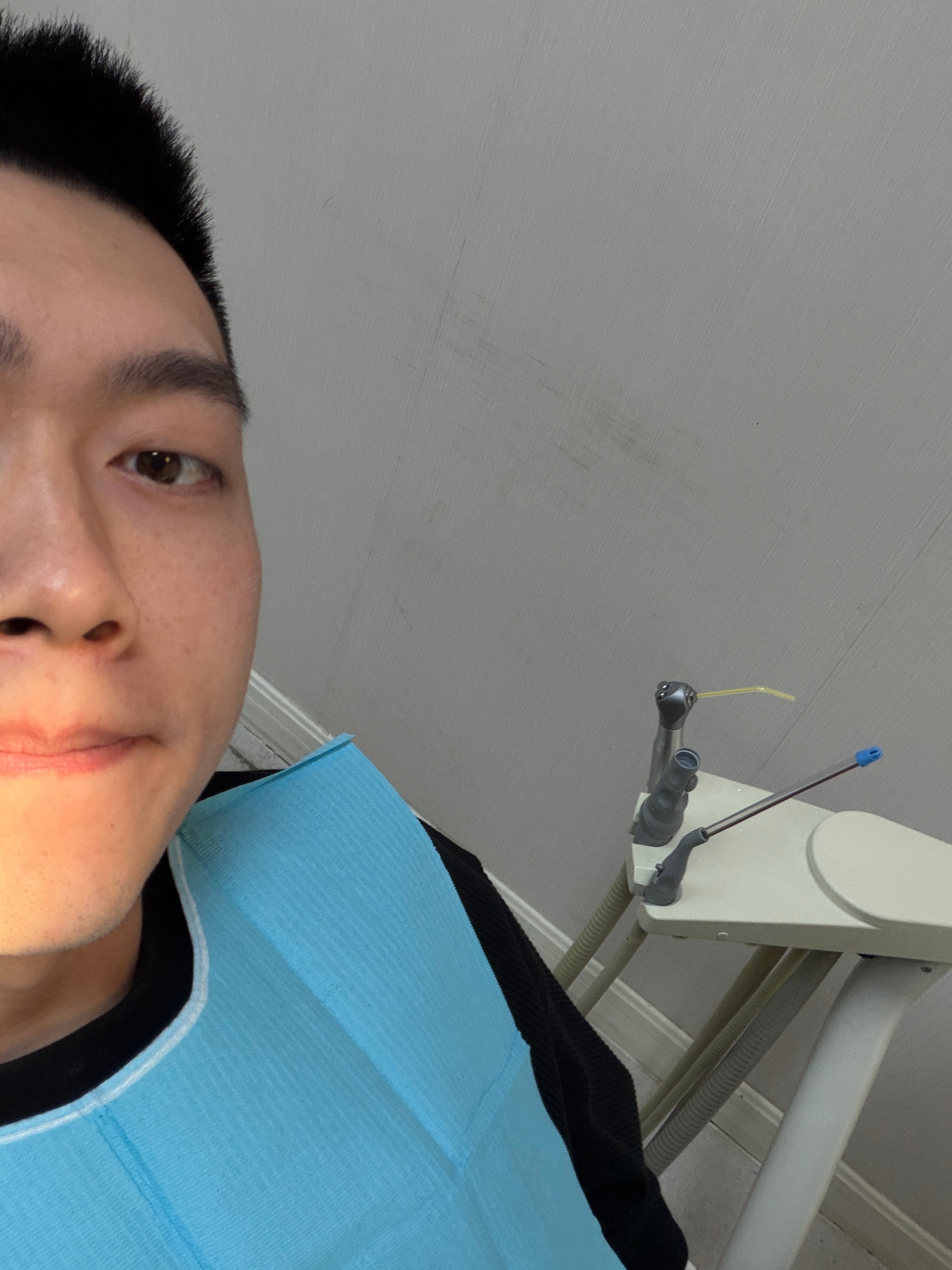 骑摩托车受这么多次伤，无论是手术还是植皮哥们儿都不带怕的。但看牙，我是真的怂！心