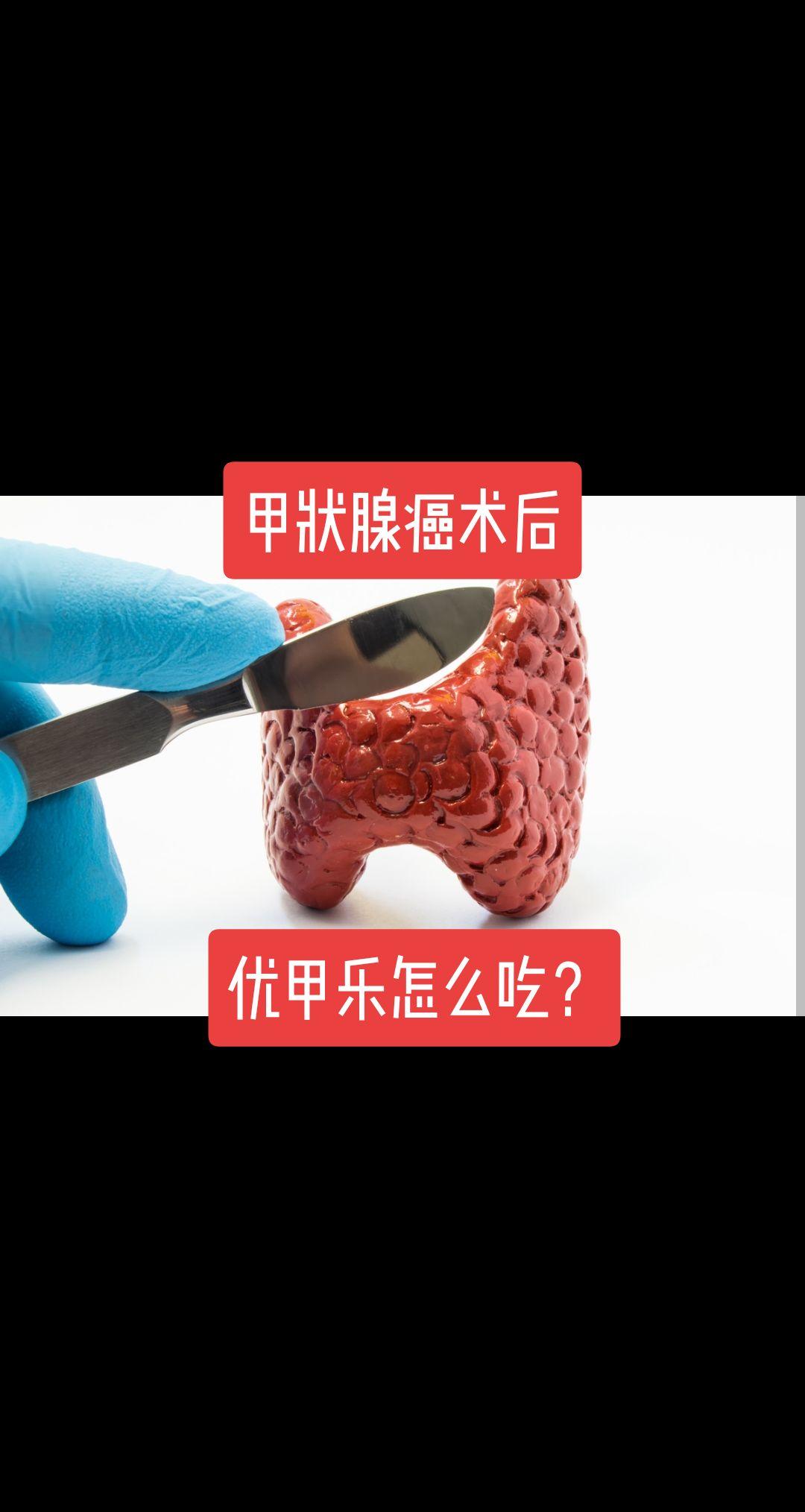 优甲乐怎么吃？🍁🍁🍁🍁🍁🍁
甲状腺癌手术了，就得吃乐乐
这也是很多人术前害怕手术的原因
可能需要吃一辈子。
👿👿👿👿
药药怎么吃？
早餐前半小时空腹吃（不展开）
吃多少合适？
理论上吃的越多，癌复发转移风险就越低，但是吃的越多，药物副作用也越大。
所以需要找一个合适的点，既能最大限度降低肿瘤复发转移风险，又能最大限度降低药物副作用风险。
这就是所谓的“双风险评估原则”。
具体怎么吃比较好？🙀🙀🙀
1，一般而言，如果肿瘤早期，无明显淋巴转移或者很少，那优甲乐可以少吃点，将促甲状腺激素