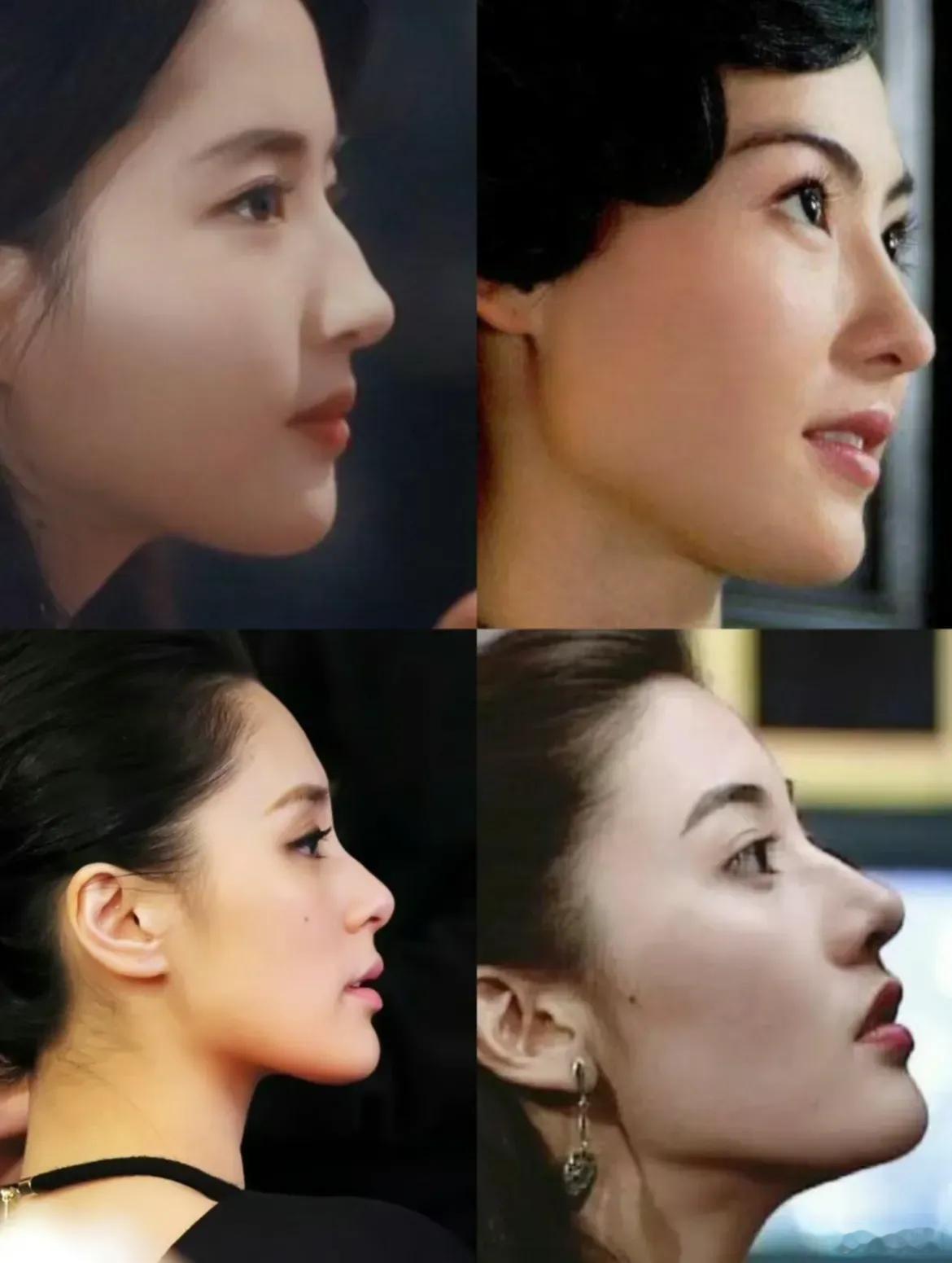 以前的娱乐圈审美vs现在的娱乐圈审美，对比一下，有没有觉得现在娱乐圈真的很搞笑…