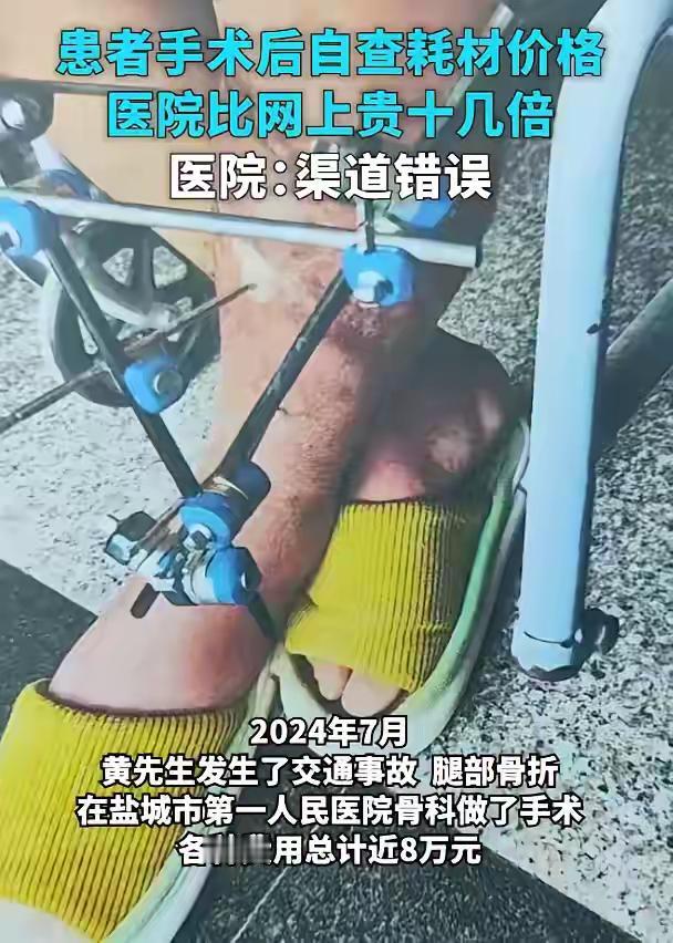 2024年，江苏盐城，一男子到医院进行腿部骨折手术，术后无聊逛淘宝时发现医院给自