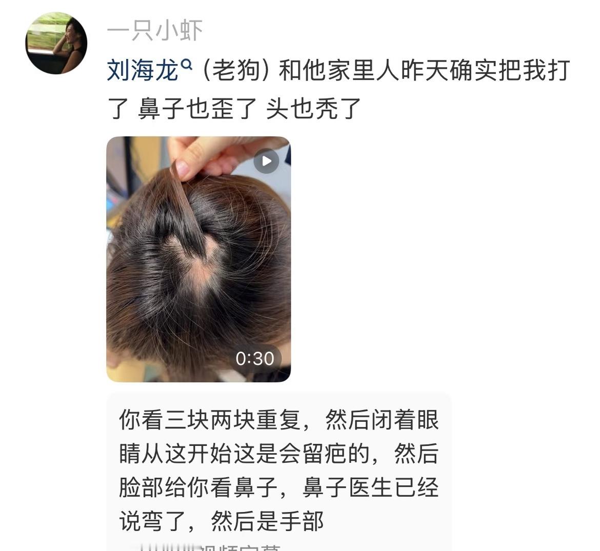 韩安冉赔偿助理10万元 伤成这样才赔10万块钱吗，韩安冉什么时候这么小方了。 