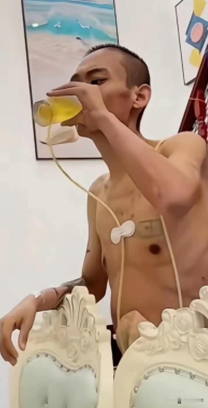 想开了，男子身患肠癌晚期，身上插着管子，独自喝闷酒，男子说：已经无力回天了，生死