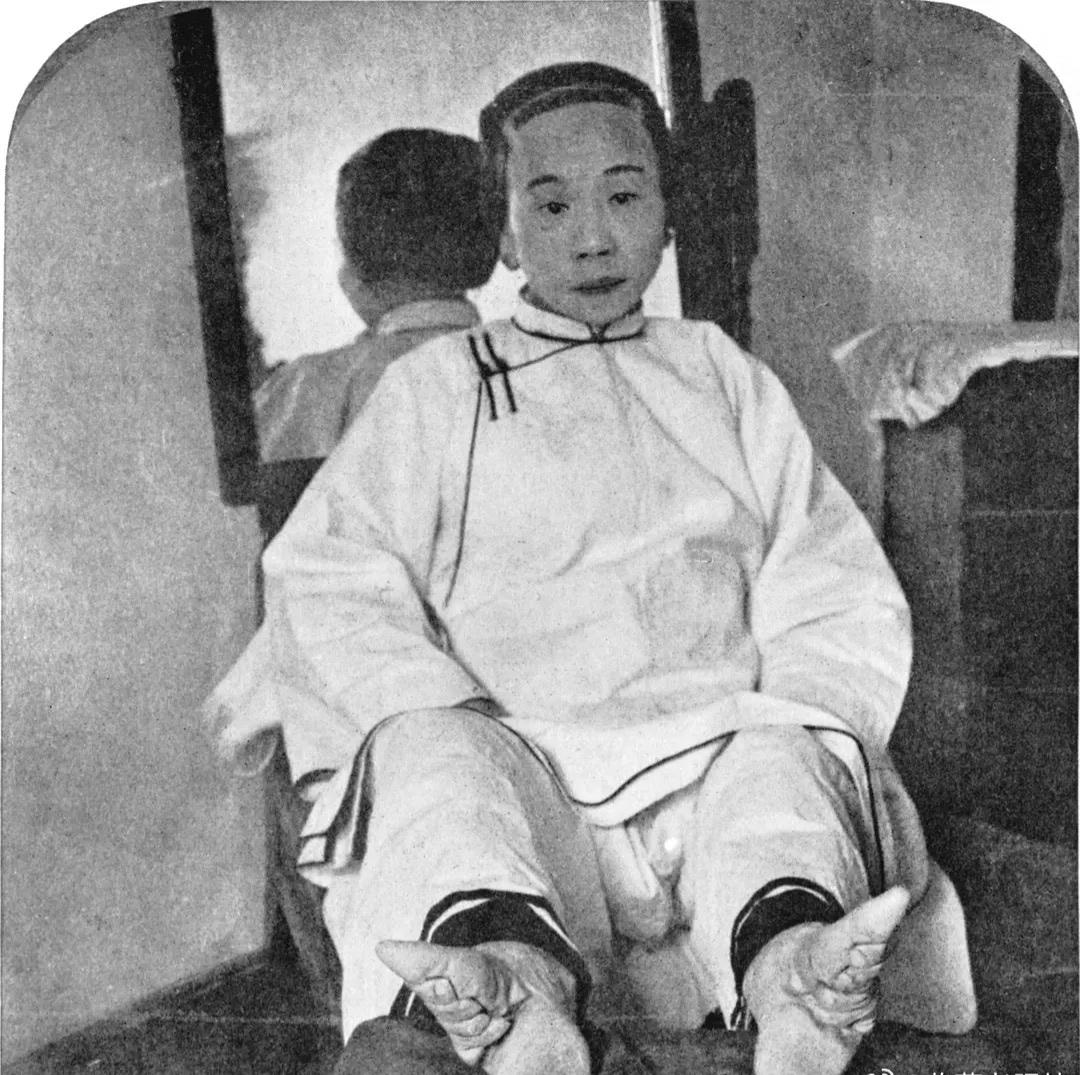1900年上海，展示三寸金莲。

在清朝， 普通人家女孩通常在四五岁时，骨骼尚未
