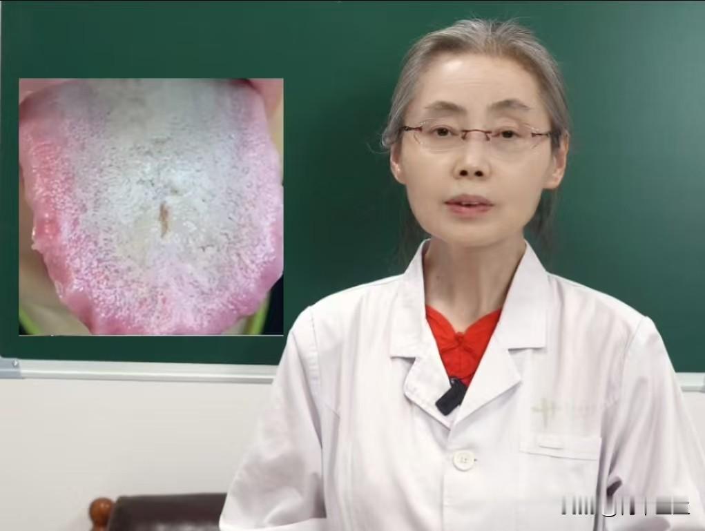 总是想入非非，欲望大，但“状态”差，是怎么回事？

有粉丝留言，让帮其看一看舌象