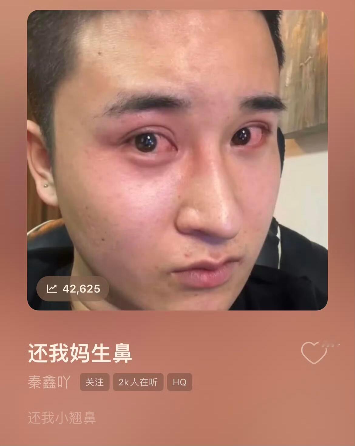 《还我妈生鼻》 太上头了❗️循环播放一天了，我还有的救吗？[苦涩] ​​​