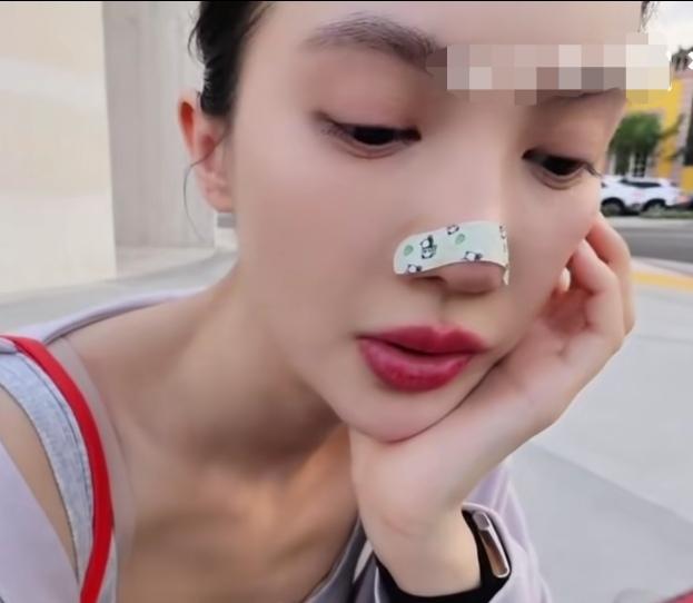 还以为金晨的鼻子受伤了，帖的创可贴。结果不是，人家的鼻子好好的没受伤。

原来金