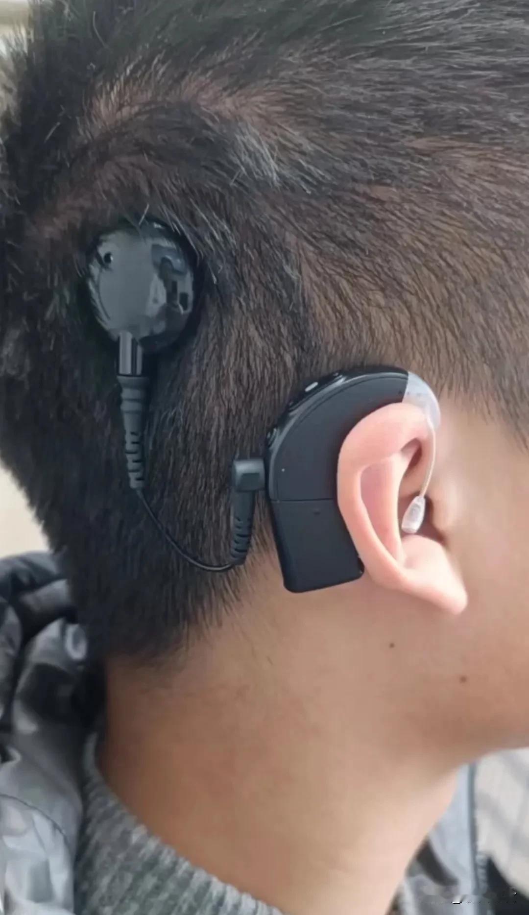 在江西九江，一名双耳失聪的男生的人工耳蜗不翼而飞，使他不得不中断学业返回家中。家