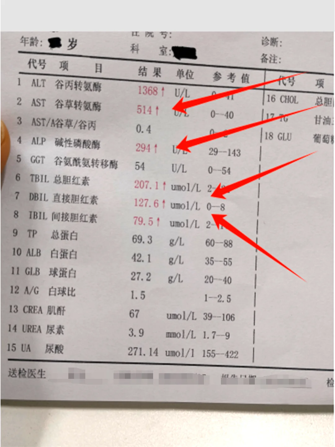 又是一例肝硬化，不应该犯这个错！