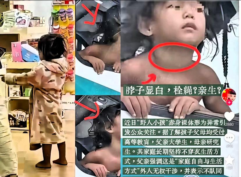 看“野人小孩”的体检报告，
我气得手都抖了！
这哪是自然养育？

刷到“野人小孩