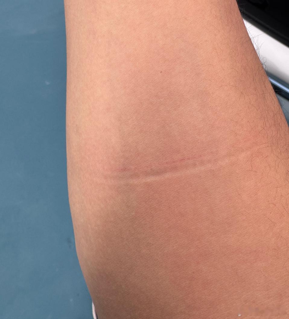 测了一下前备箱的防夹，给哥们夹红温了