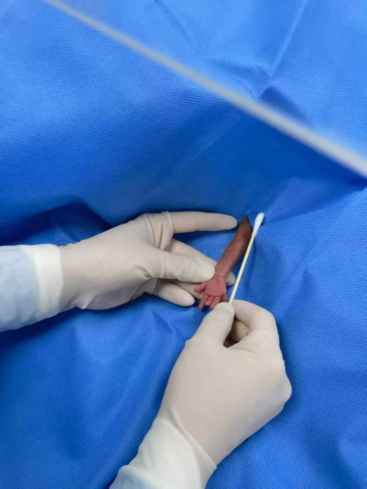 380克迷你宝宝获救出院，刷新河南最低体重早产儿救治记录