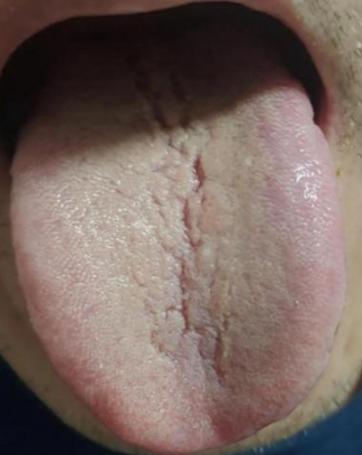 男人纵欲过度，阳虚时间短！桂附地黄丸越吃越火？先清后补才管用

临床发现，80%