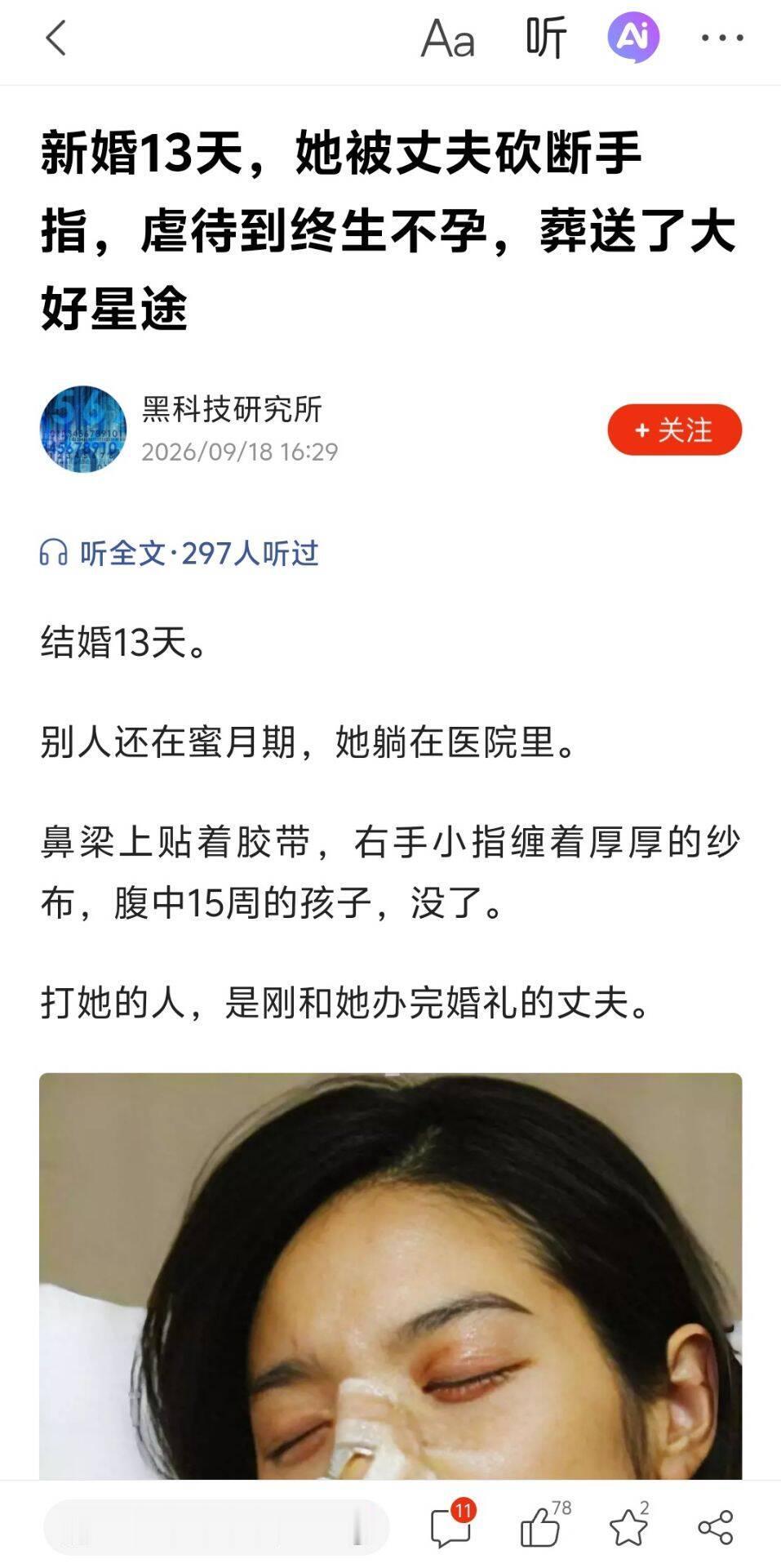 记者会照片里，李敏英躺在不到五平方米的病房中，右手小指包着纱布，鼻子外固定着敷料