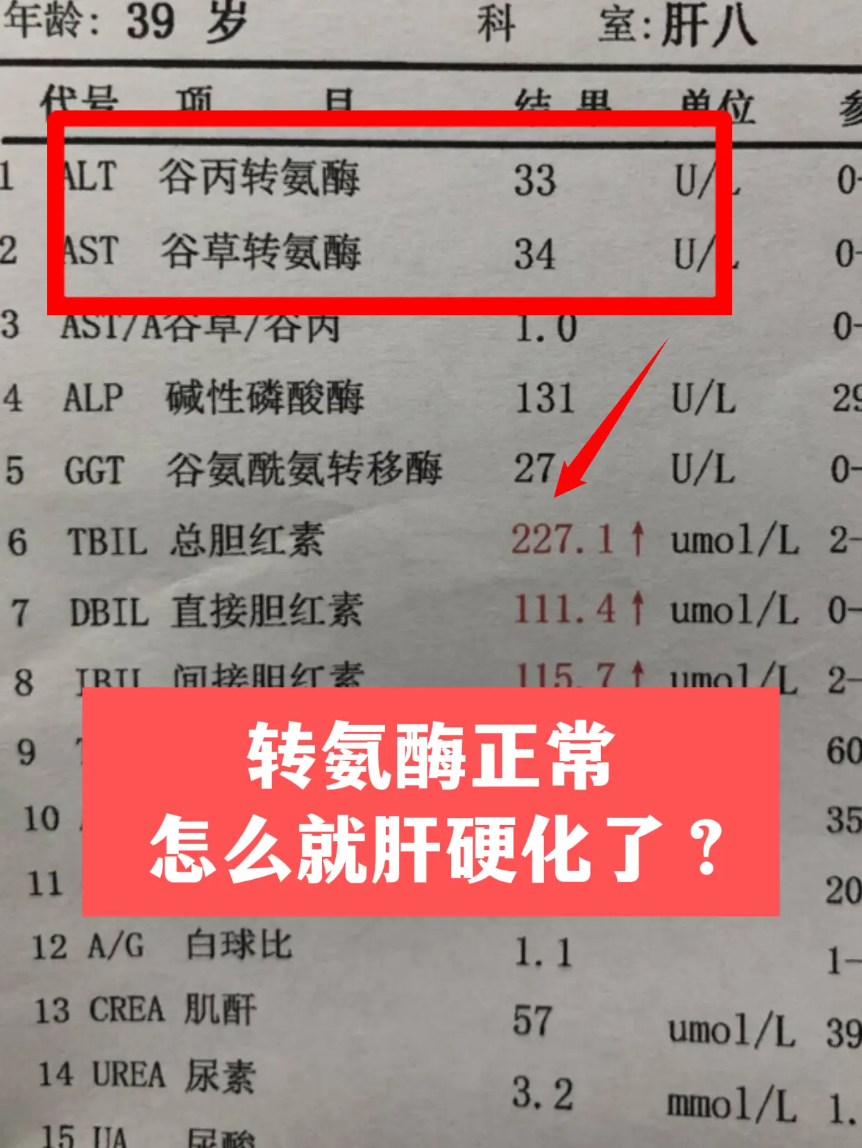 山东德州一位患者来复查，一坐下就很委屈地问：“教授，我转氨酶一直正常...