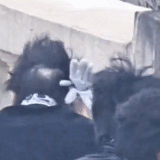 这是谁的后脑勺？头发好少啊 