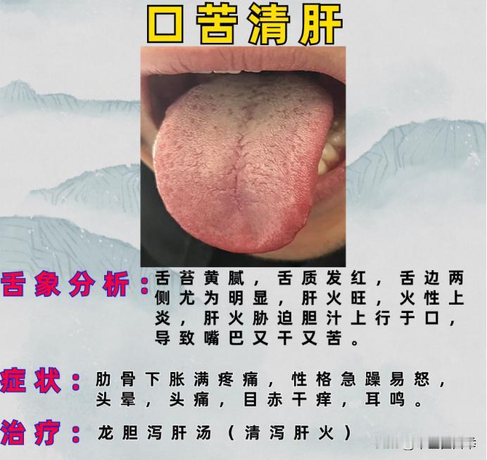 养肝就是养命，具体怎么养，一文讲清楚！#健康##养肝##中医#