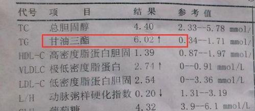 血管好不好，不是看箭头！血脂报告单上这3个数，多数老人盯错了地方
拿到体检报告那