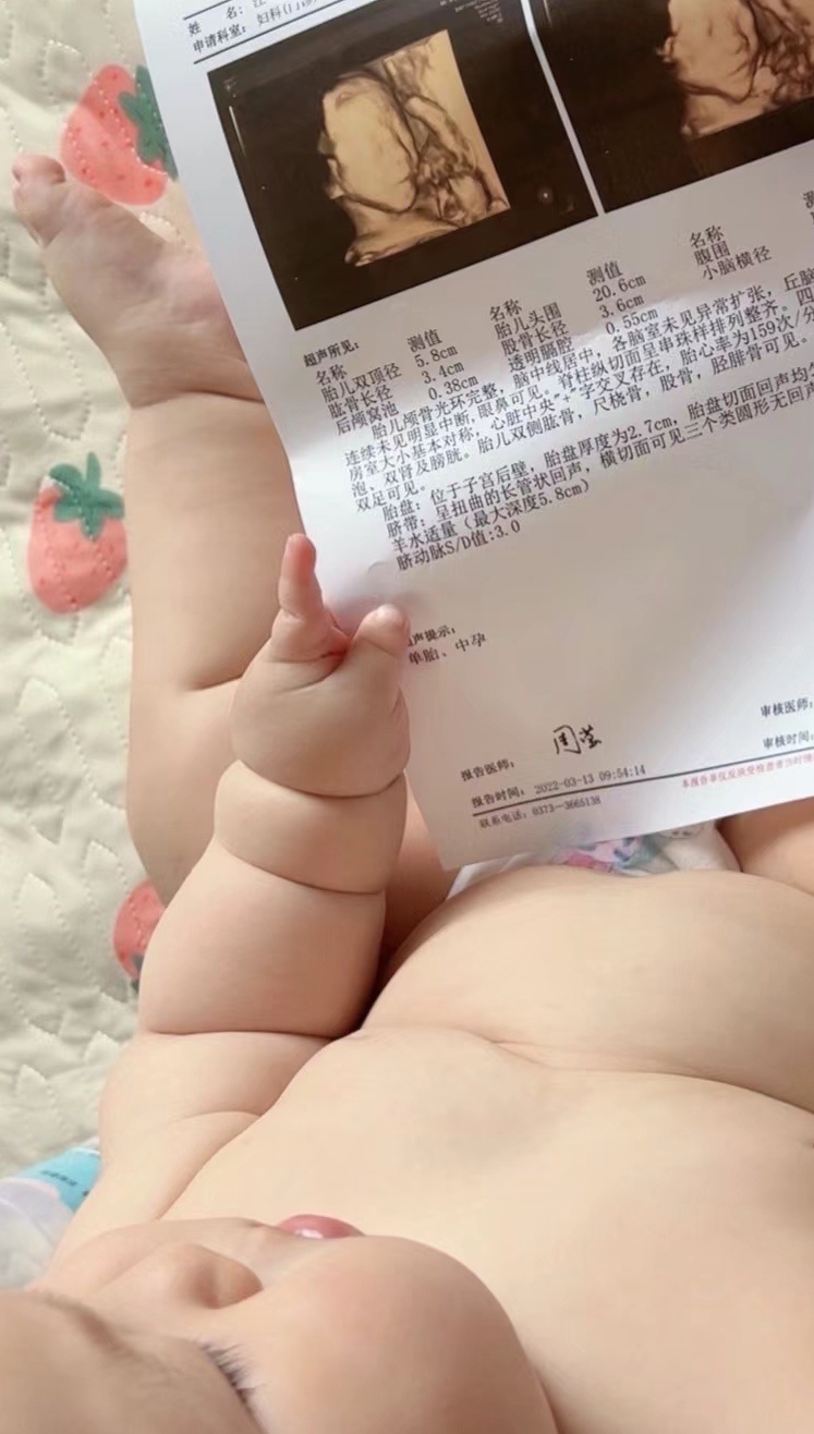 此时，一位米其林轮胎宝宝看着自己年轻时候的照片陷入了沉思。 ​​​
