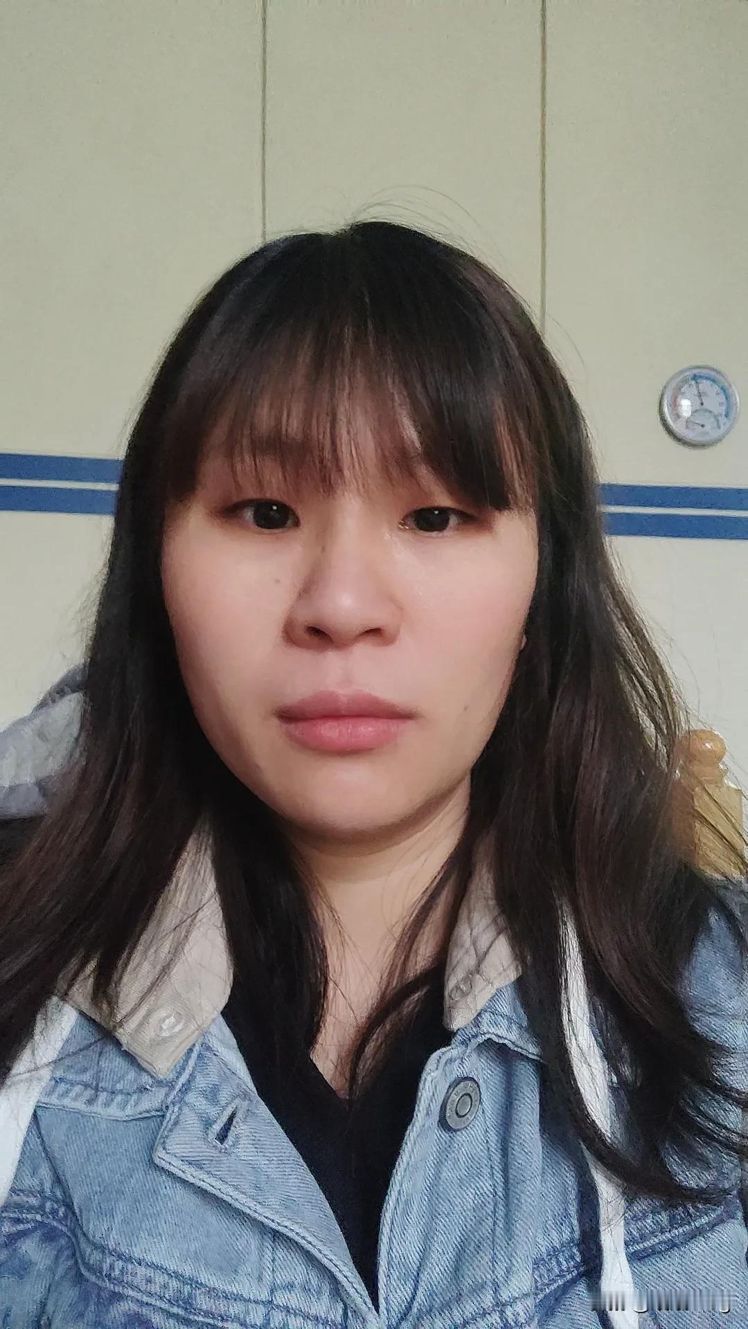 好奇怪为什么一只眼睛大一只眼睛小，这是怎么了[泪奔][泪奔]
