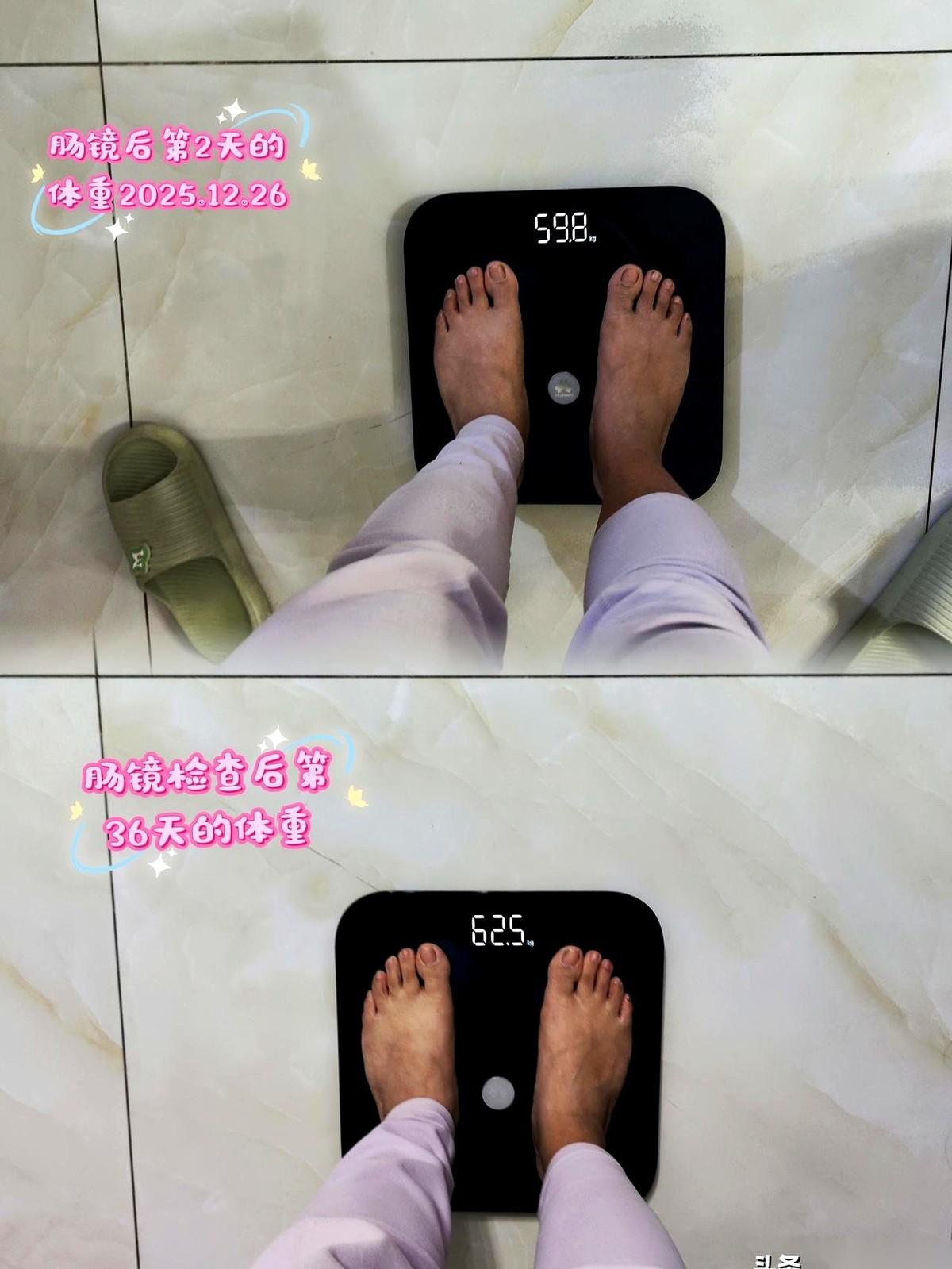 管子还在身体里，屏幕上是两个小点，医生扭头问我，切吗？
我盯着那个冰冷的屏幕，几