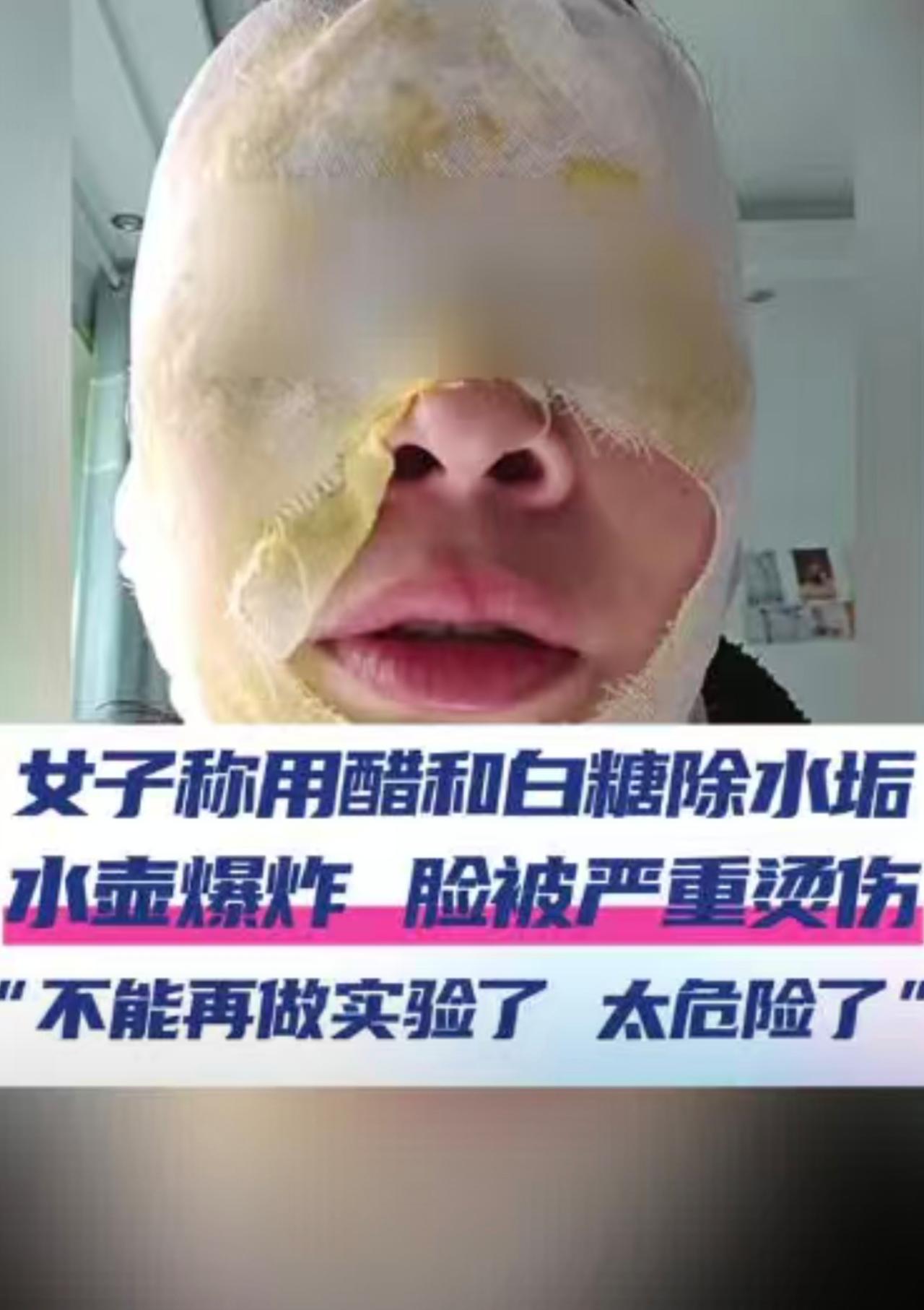 10月9日（采访），河北邯郸一女子称保温壶有水垢，在网上搜了教程，把白醋和白糖烧