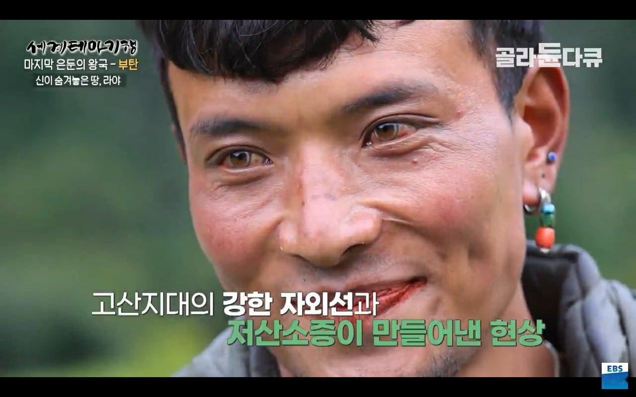 不丹高山地带的居民，眼睛的样子是高山的强烈紫外线和低氧所造成现象，怪异带来的“漂