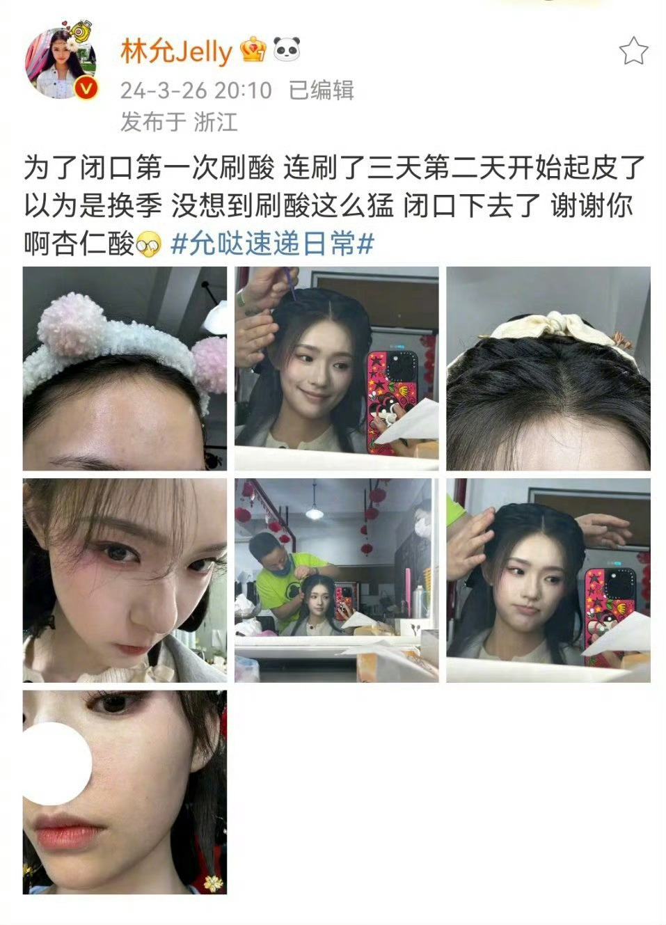 #林允为闭口第一次刷酸# 美妆博主•允 上线，姐尊的很爱研究变美小妙招啊，不错不