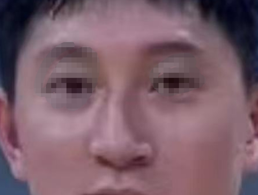 这鼻子歪成鸡翅拐了，人生高度被局限了。事业财运婚姻都受影响。 ​​​