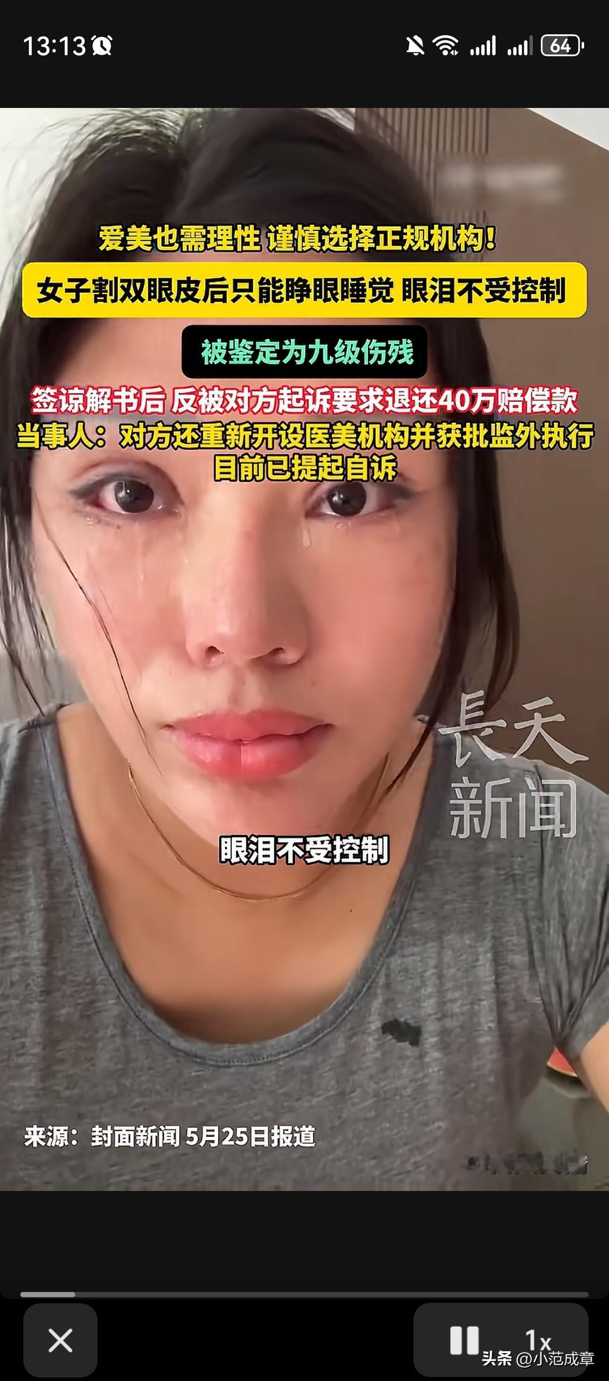 苏州一女子花1万2割个双眼皮，结果术后只能睁着眼睛睡觉，而且眼睛还经常流眼泪，经