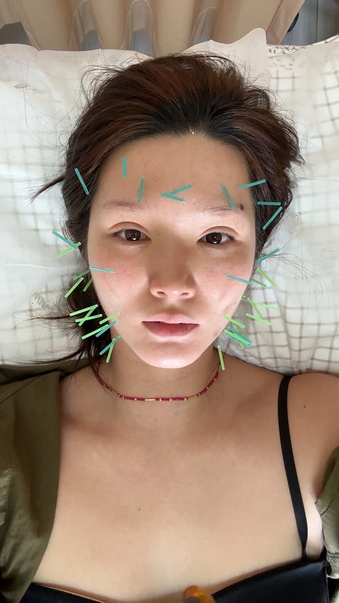 怕痛，但是说能变美