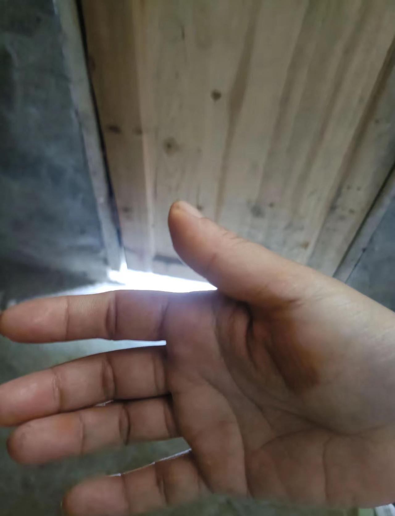 生这几天病了，天天跑医院都还没好，今天起来又淌很多好多鼻血，搞得满脸满手都是，其