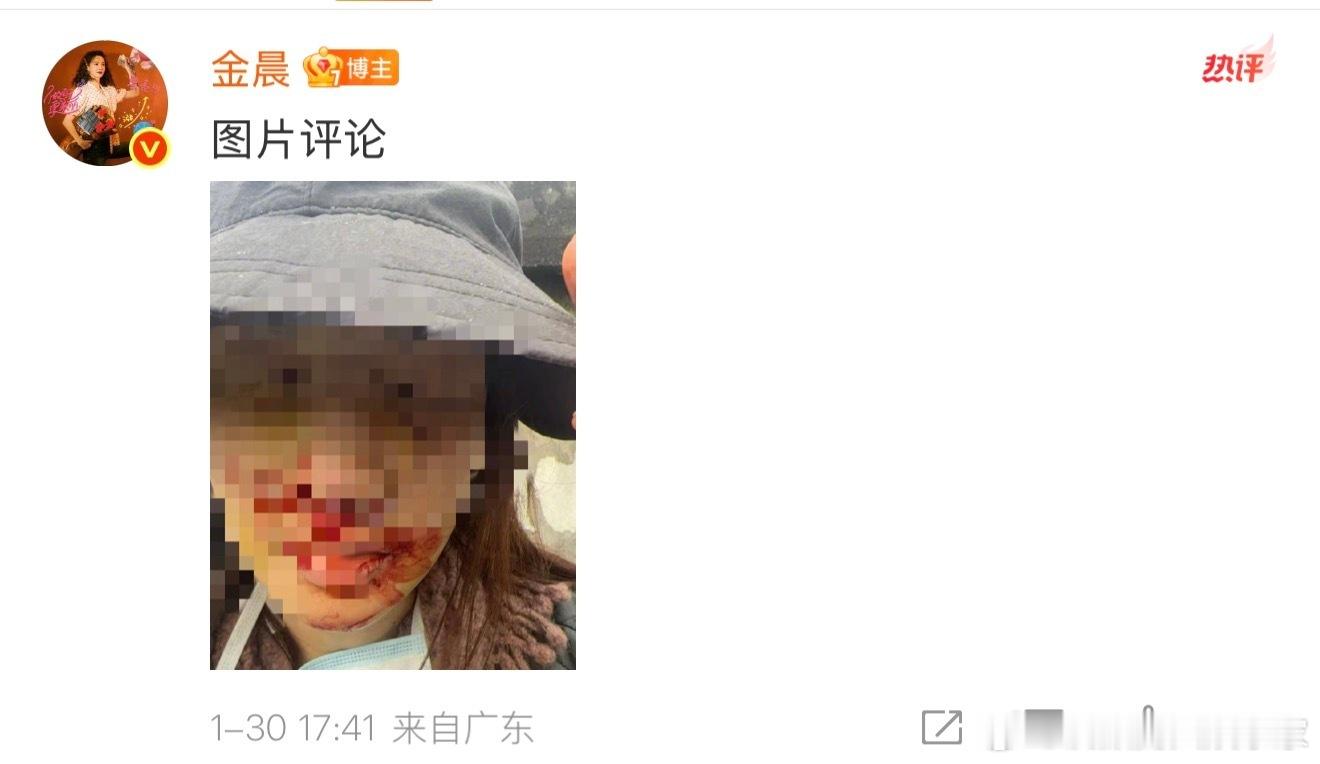 金晨就不该找人顶.包，直接报.警处理就好了。就事故本身来说，避让小狗也情有可原，