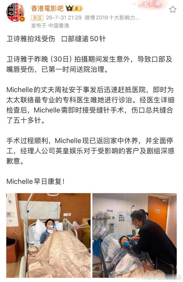 卫诗雅在成毅剧组受伤，共缝50多针女演员来讲属于大事故了，上一次剧组受伤还是那谁