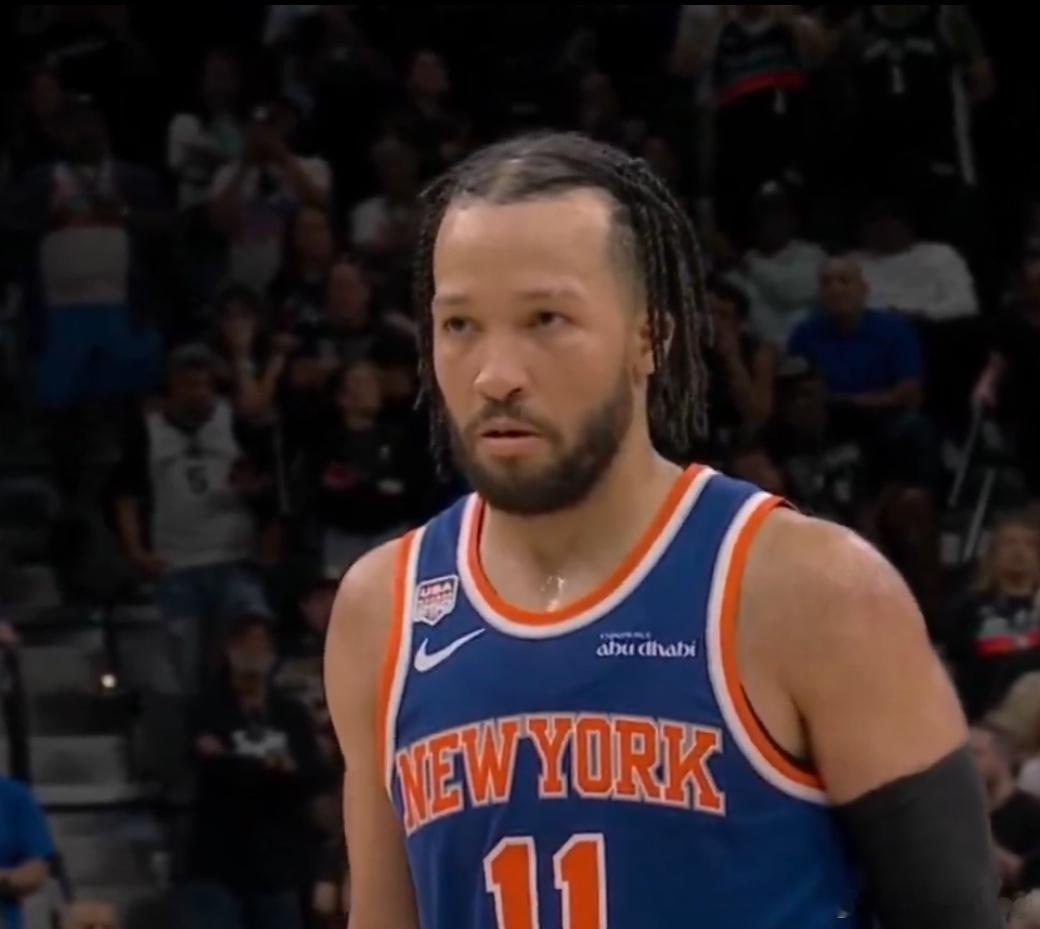 确诊为近十年最丑的fmvp 