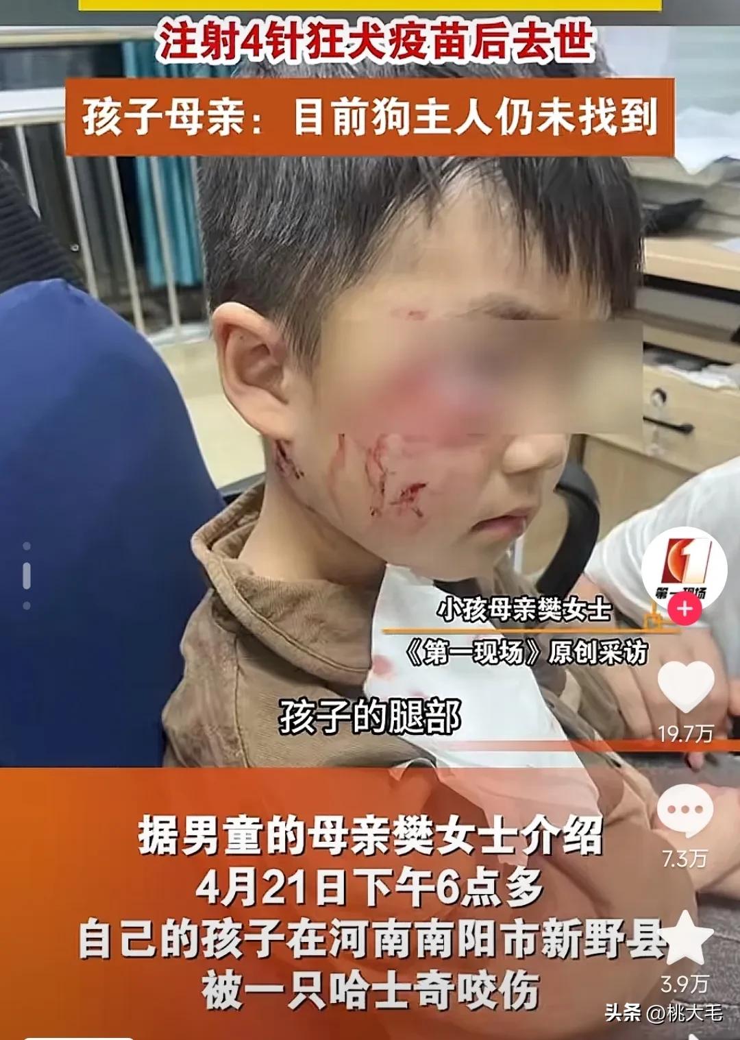 被狗咬伤的男童伤情恶化离世了，可伤人的狗（哈士奇）却可能被定义为流浪狗，因为找不
