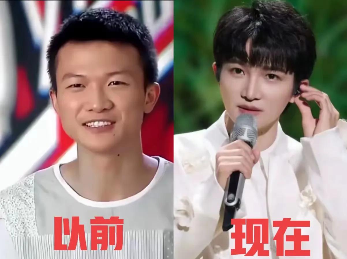 说真的，这就是有钱真好的最好案例！
有钱了，容貌都可以变得帅气，英俊，让人垂涎欲