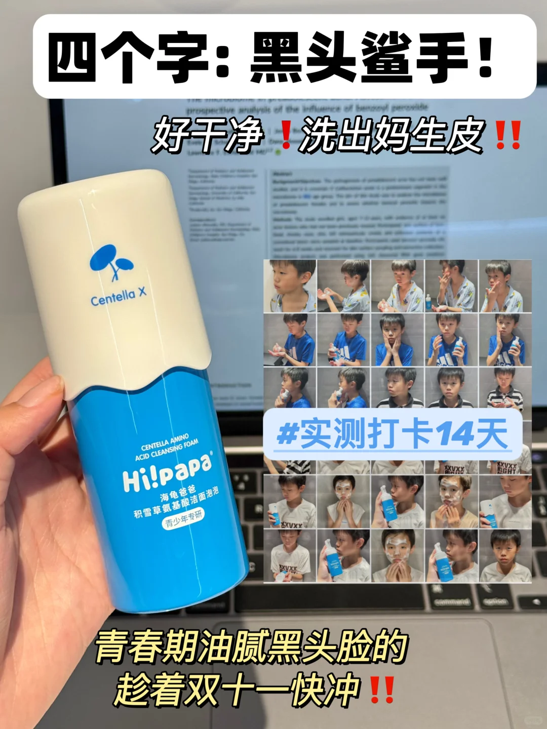 相见恨晚！双11必囤洁面！！包去黑头的