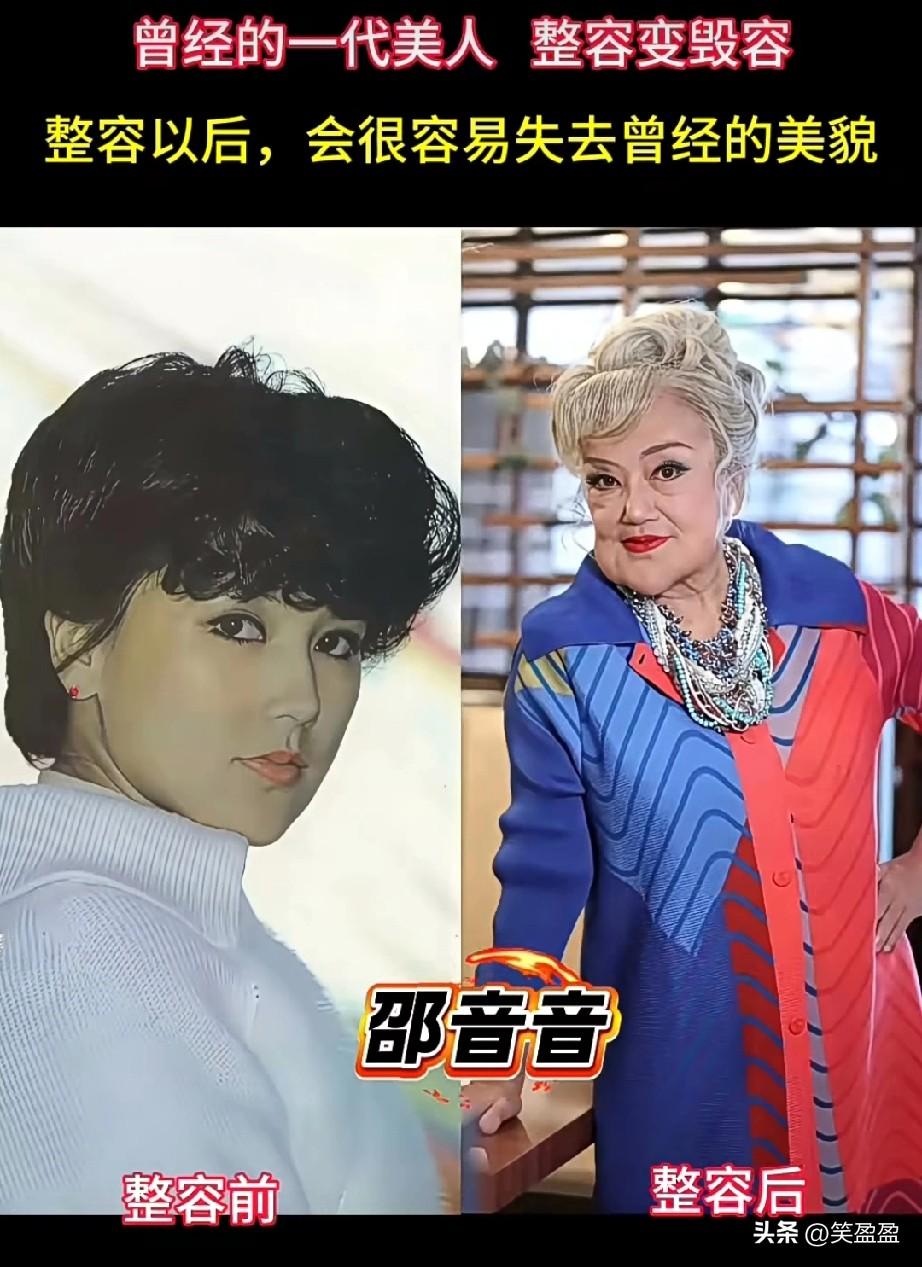 曾经的一代美人，整容后变毁容。
整容是一把双刃剑，整容以后，会很容易失去曾经的美