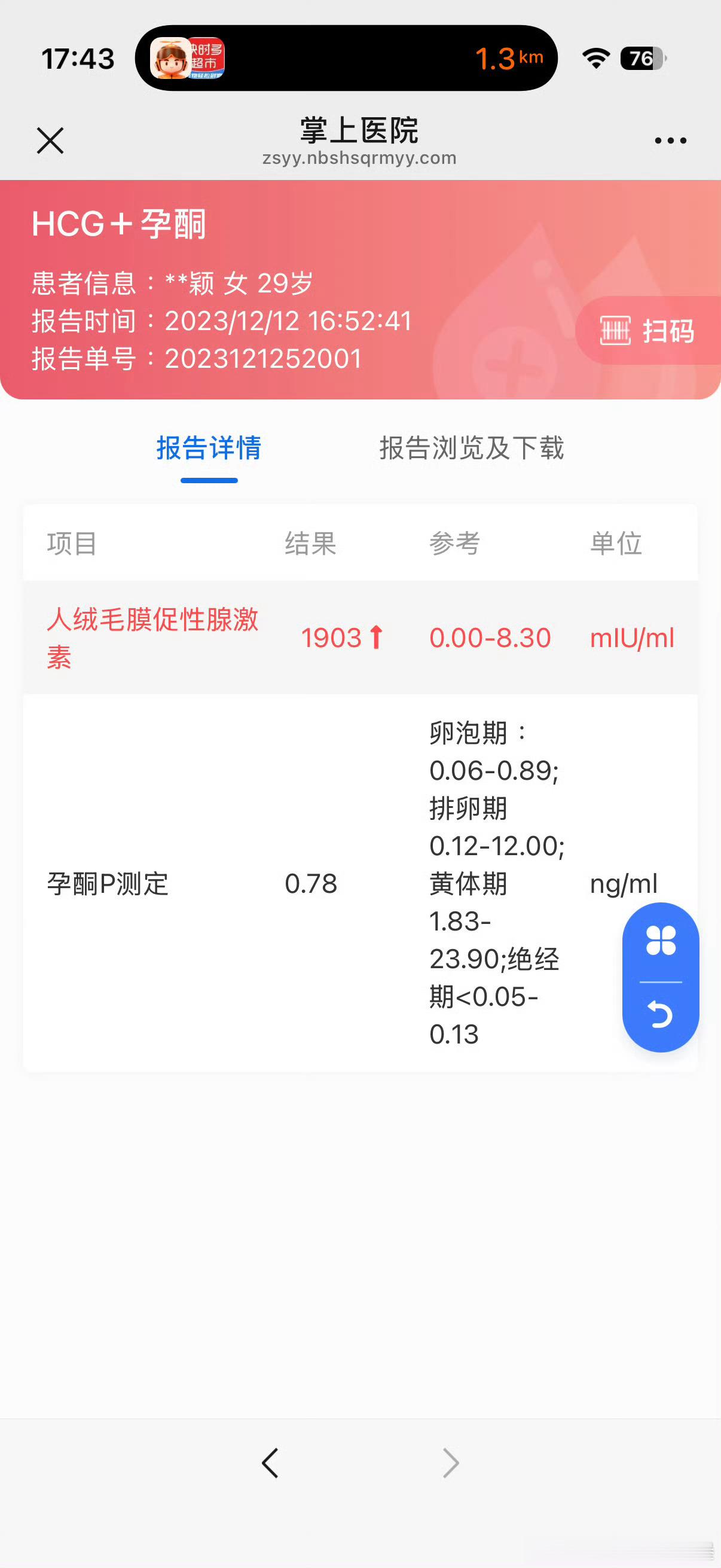 卧槽鹿单东又咋了好久没听到jb咖的消息了 