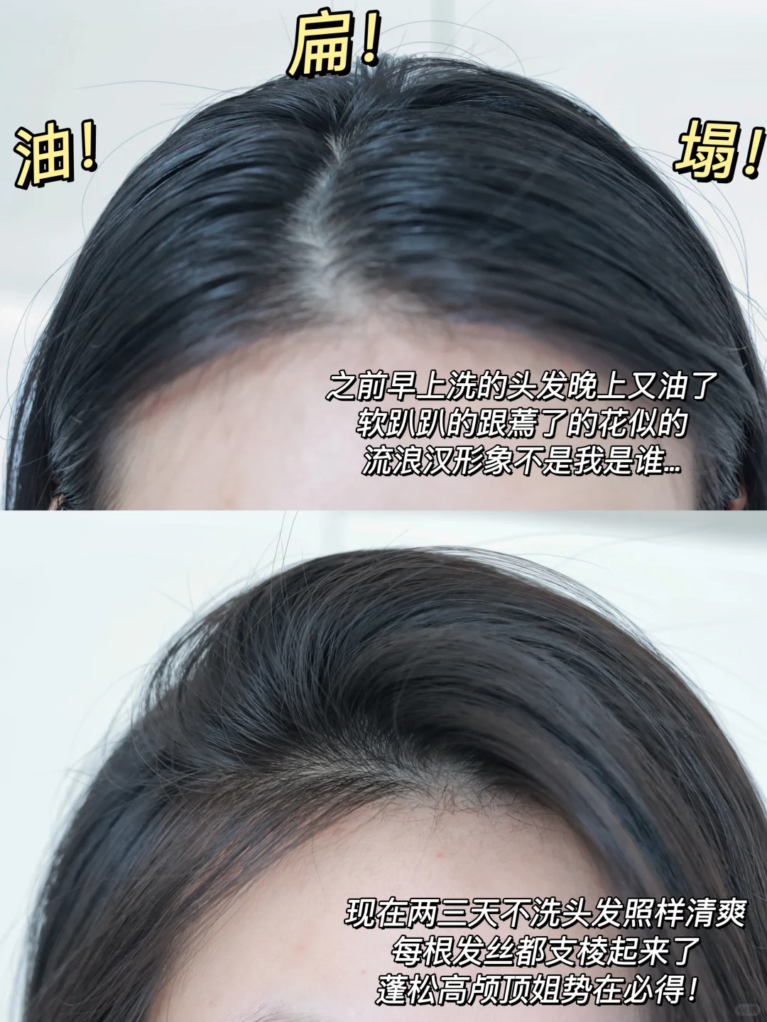 不油不塌别用！怕你清爽颅顶长出三室一厅！