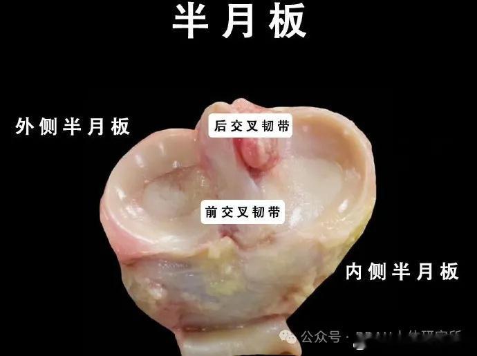 膝关节损伤 【半月板损伤】半月板伤了，手术or保守，该怎么康复？今天就来聊一聊—