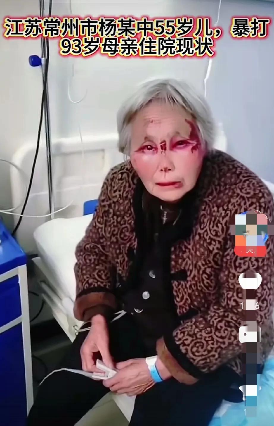 江苏常州市一男子，暴打自己93岁的老母亲，老人被打的眼角，嘴角都是伤痕累累。
打
