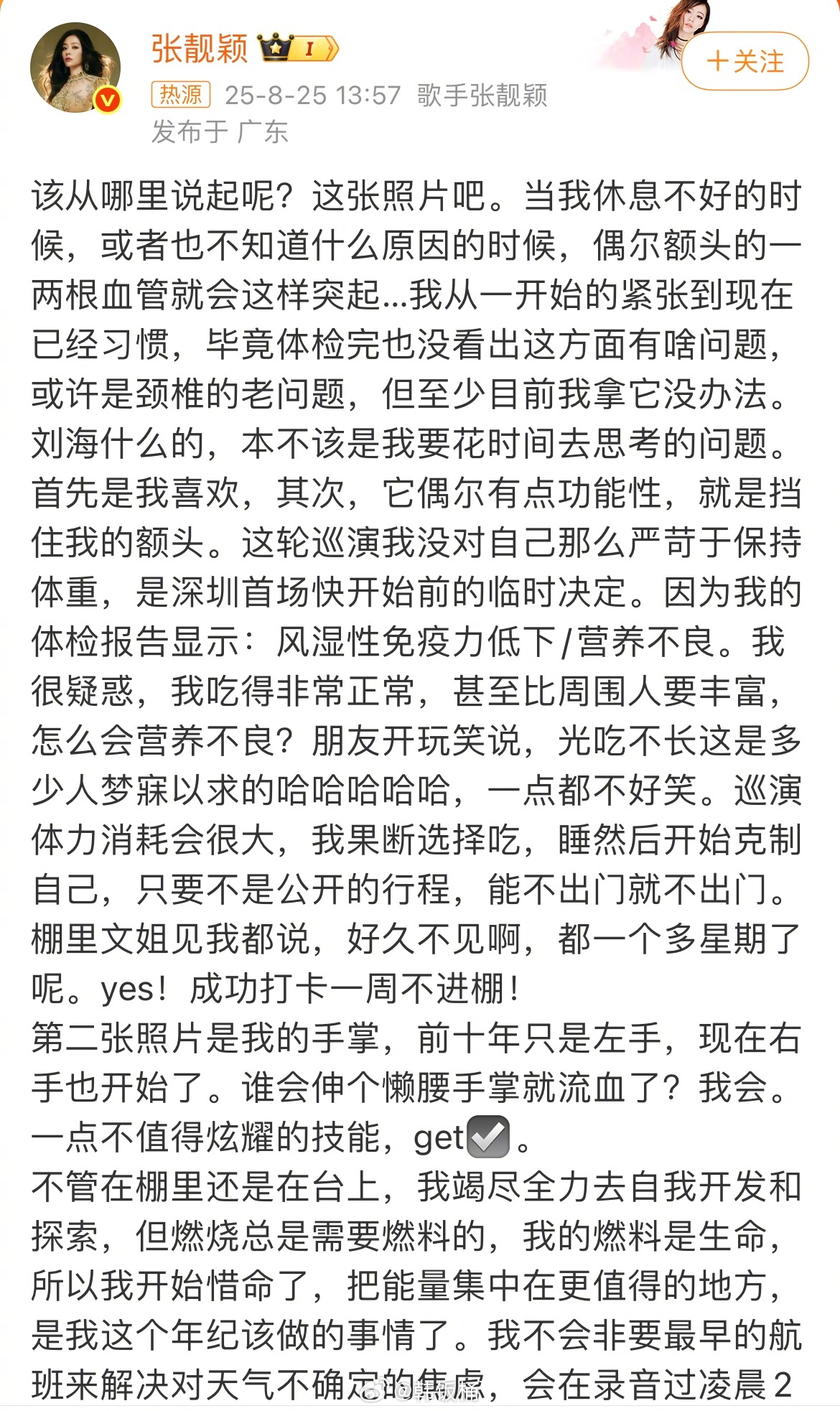 张靓颖一伸懒腰手掌就流血很喜欢这种有什么问题会和粉丝坦诚进行沟通的艺人，不管怎么