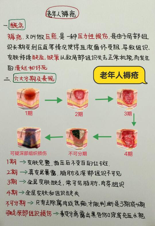 今日学习打卡——老年人褥疮