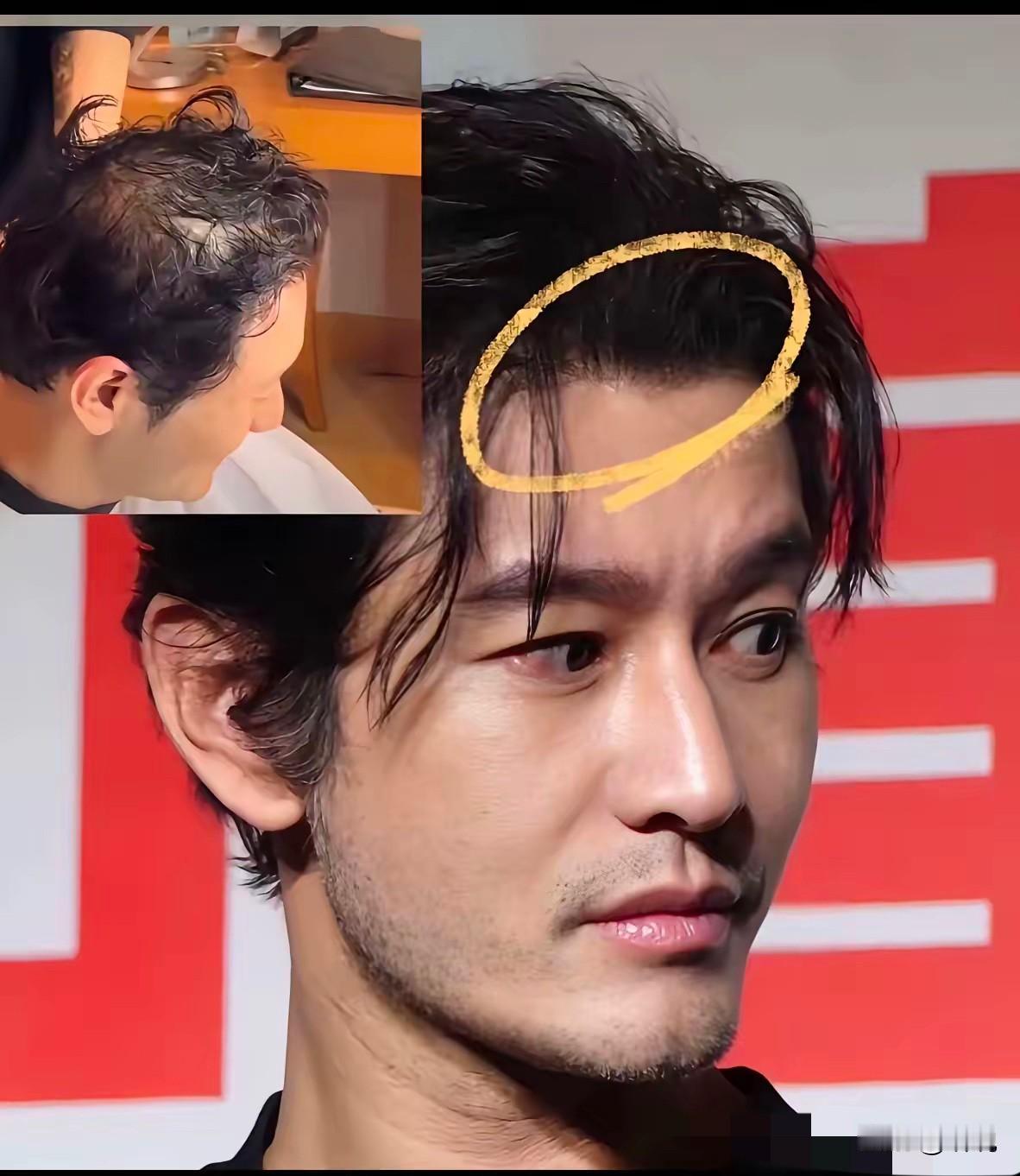 中年男人的真实发量