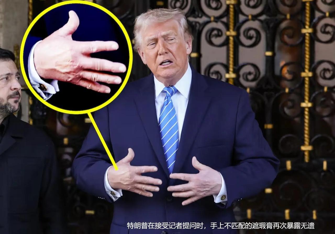 79岁特朗普自曝服药内幕，手上淤青真相曝光，白宫解释前后矛盾？
特朗普在接受《华