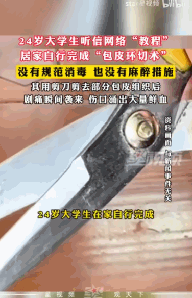 差点断子绝孙！上海，一名24岁的年轻大学生因为听信网络论坛上的奇葩教程，居然在既